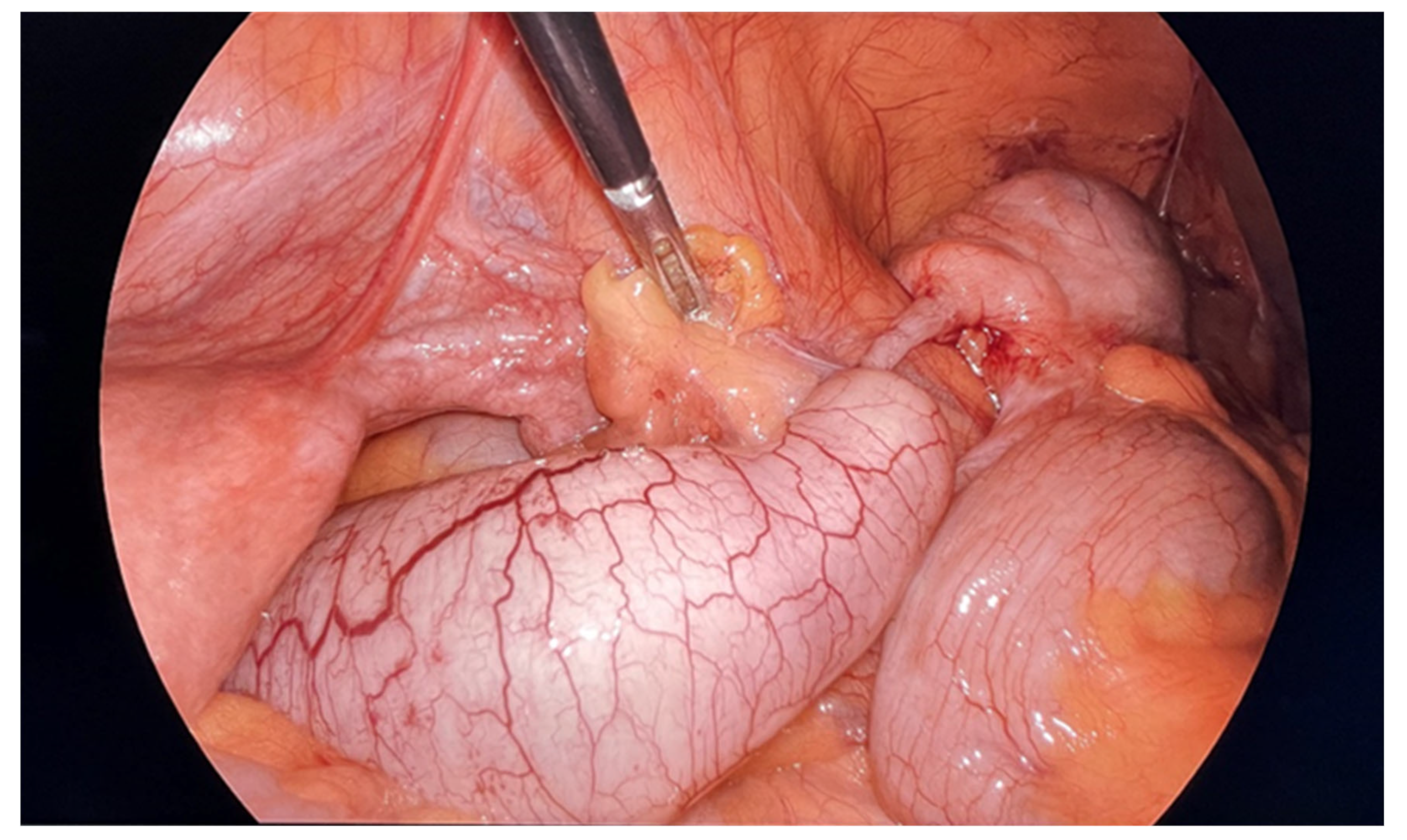 Diagnostics 14 02532 g005