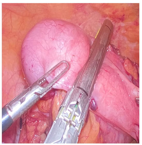 Diagnostics 14 02532 g006