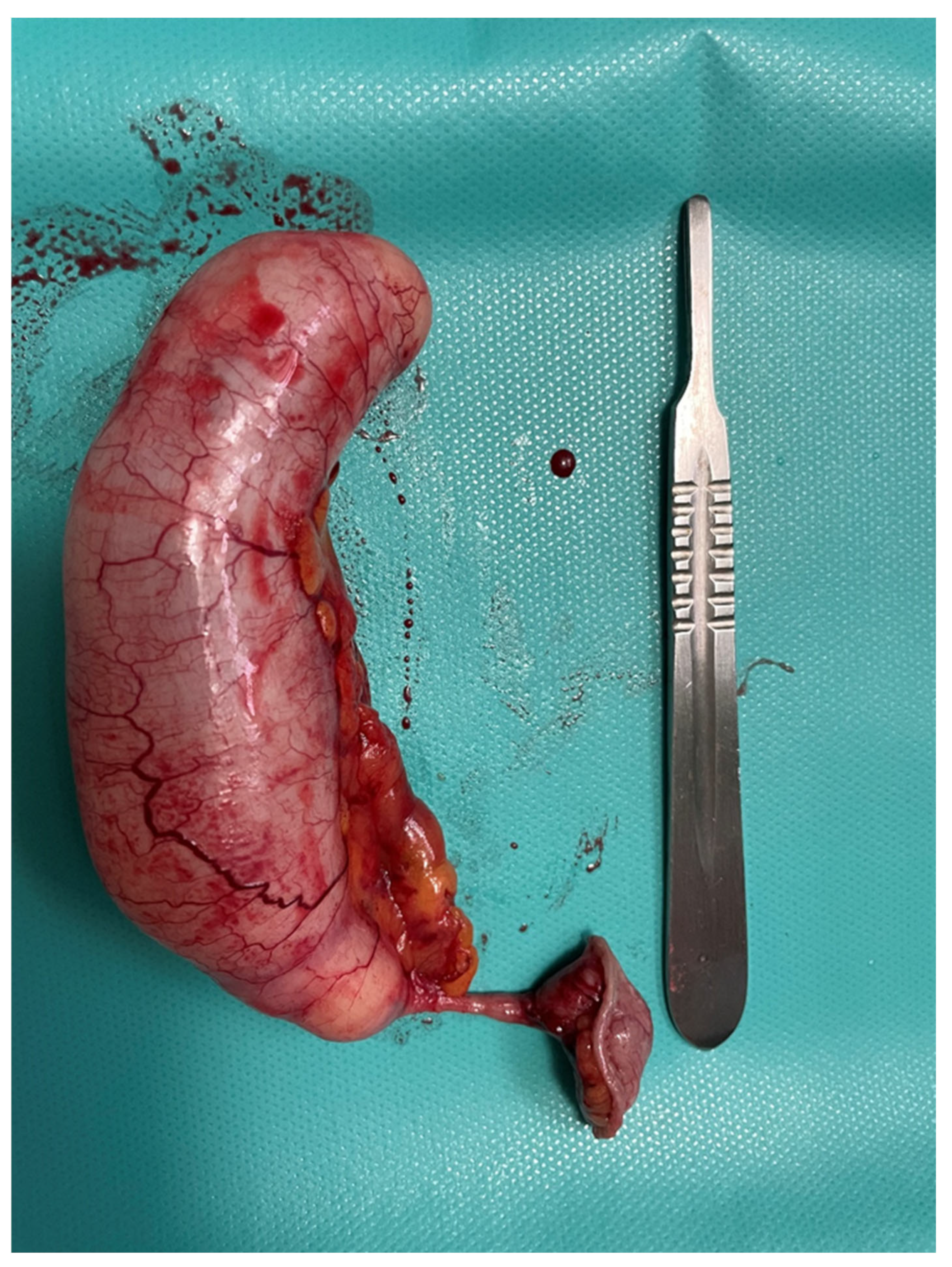 Diagnostics 14 02532 g007