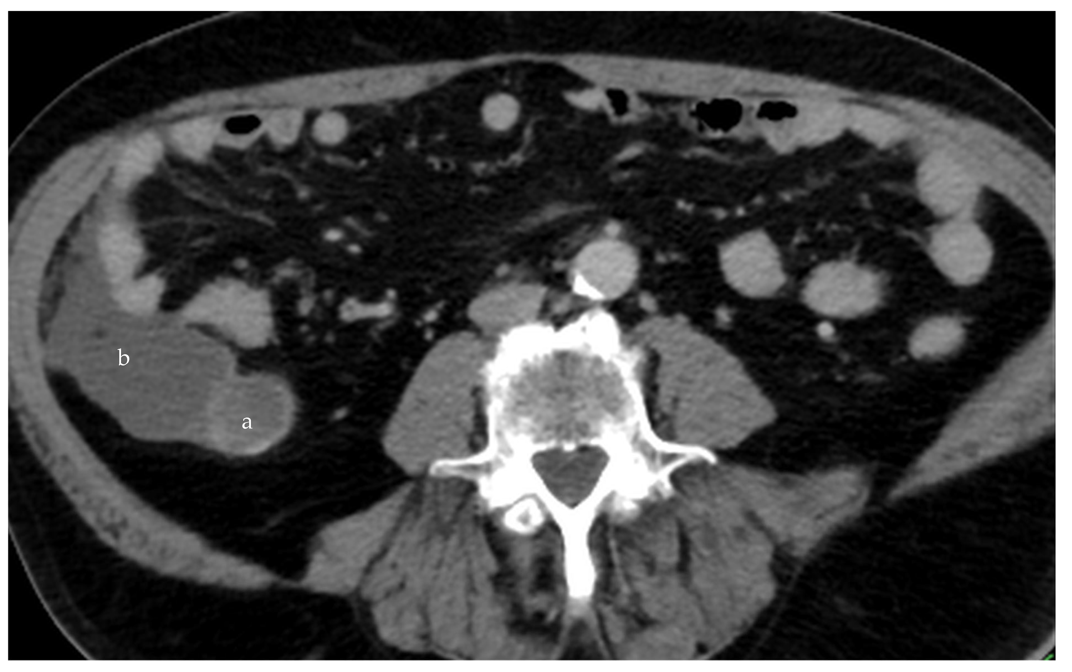 Diagnostics 14 02532 g009