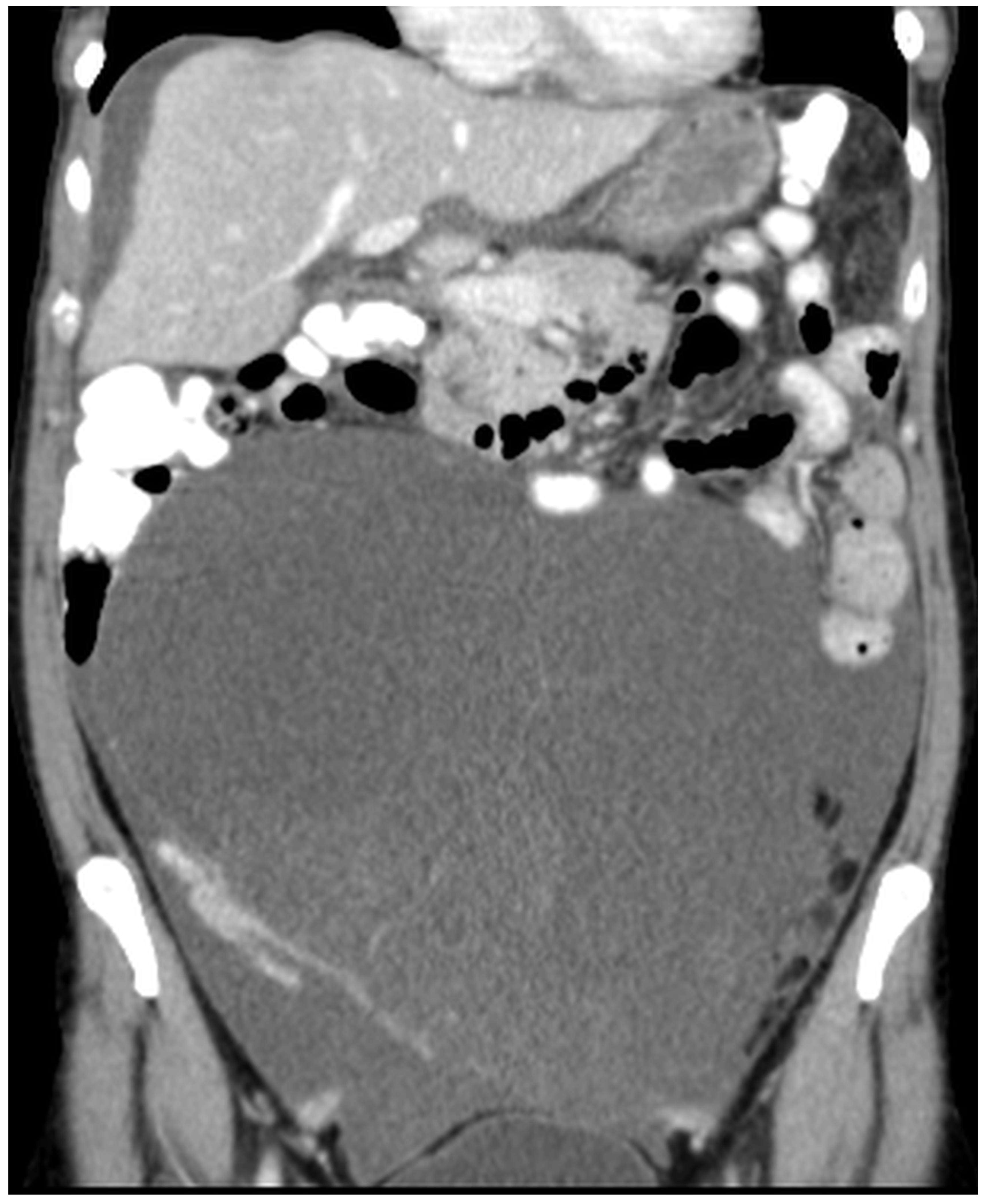 Diagnostics 14 02532 g014