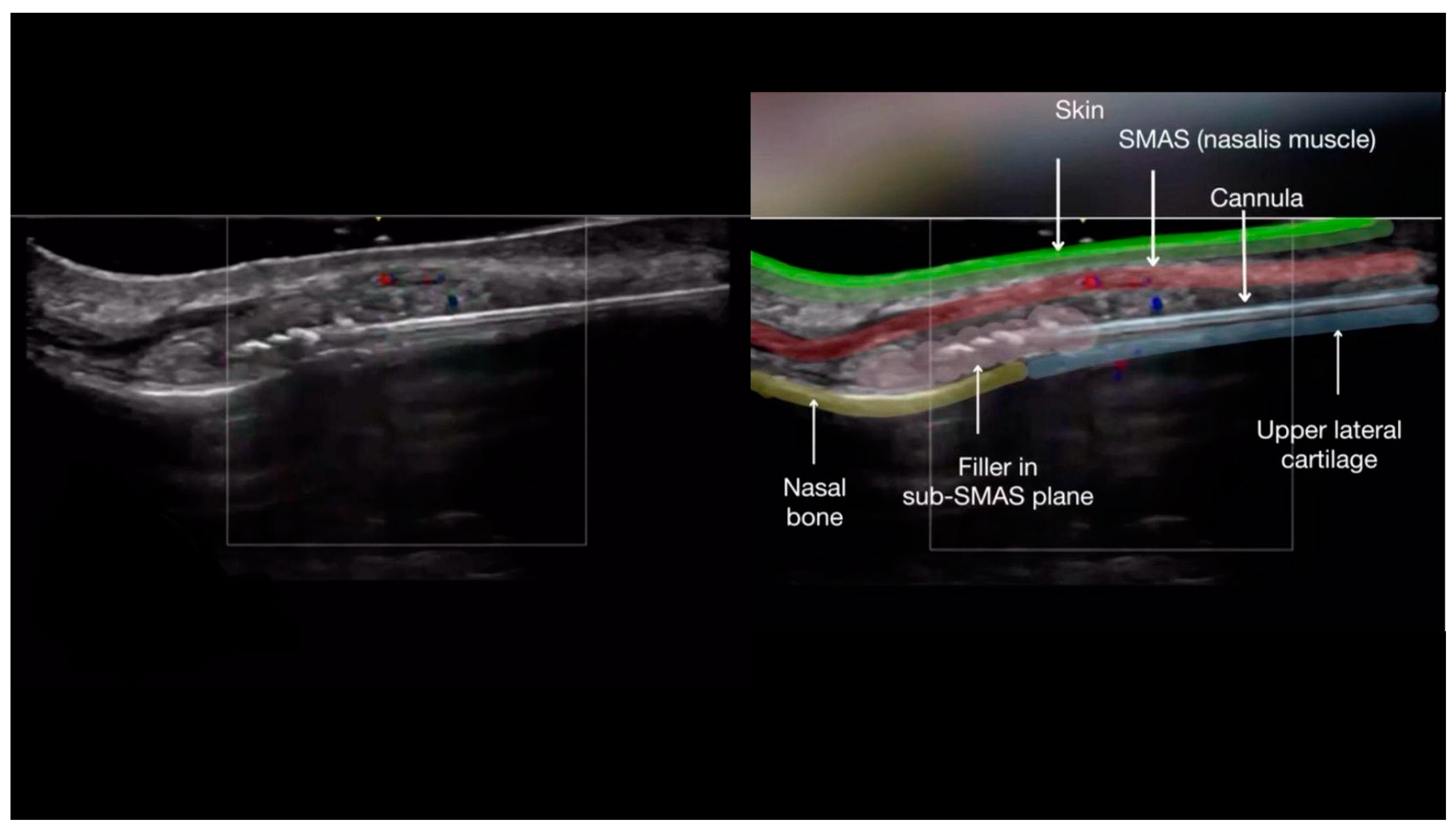 Diagnostics 14 02544 g002