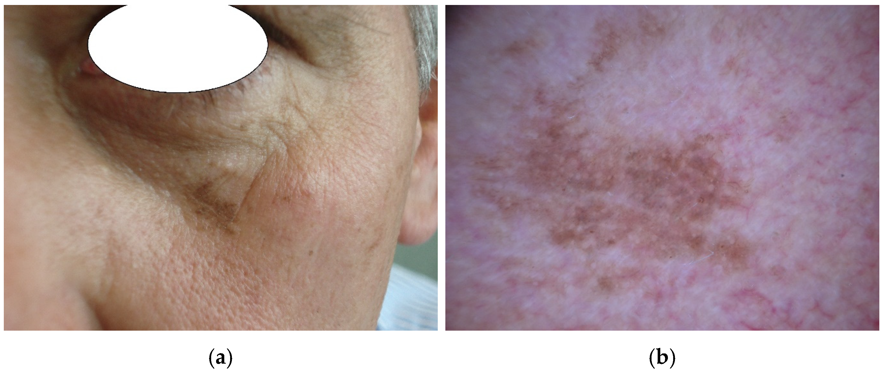 Diagnostics 14 02571 g001a