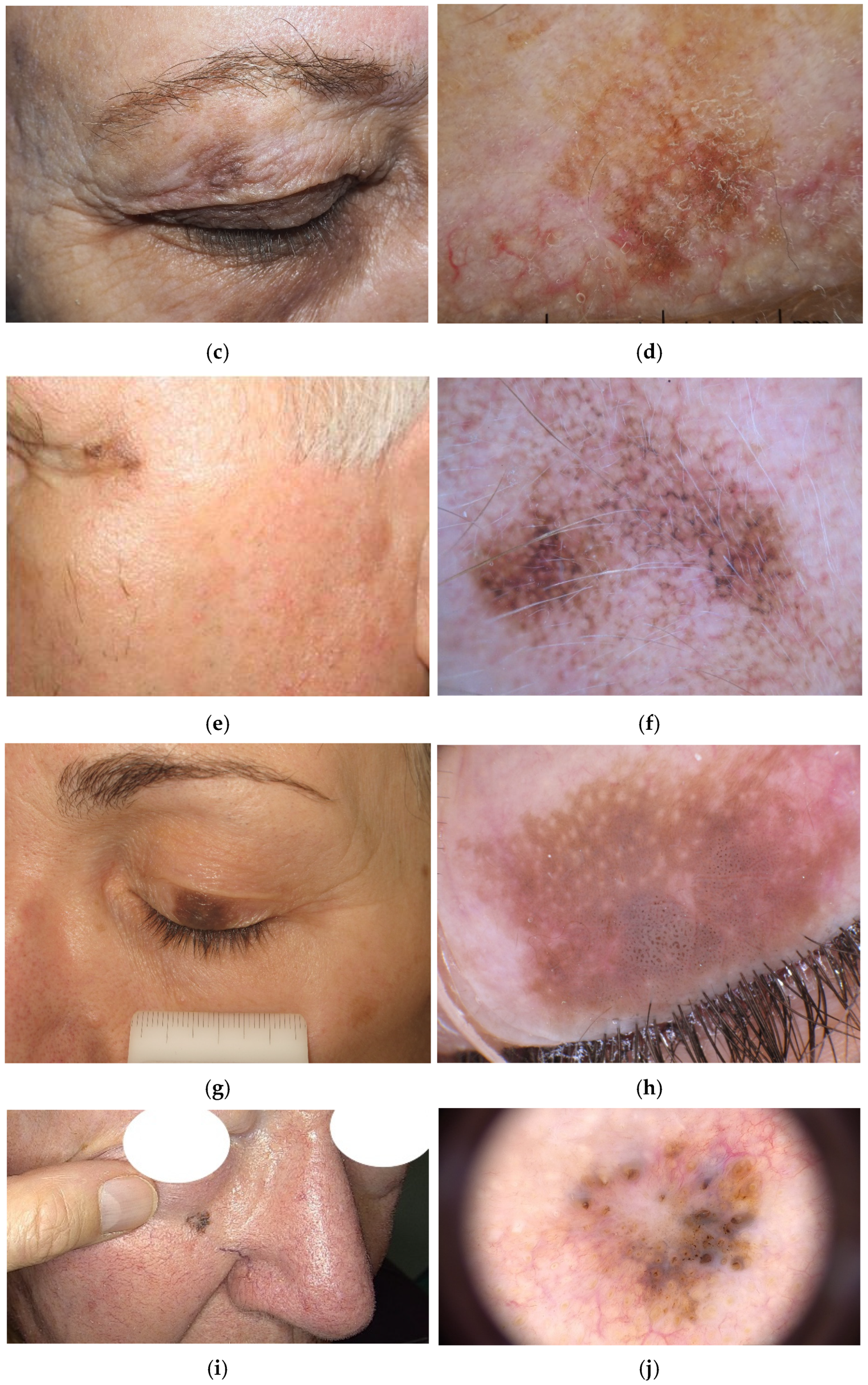 Diagnostics 14 02571 g001b