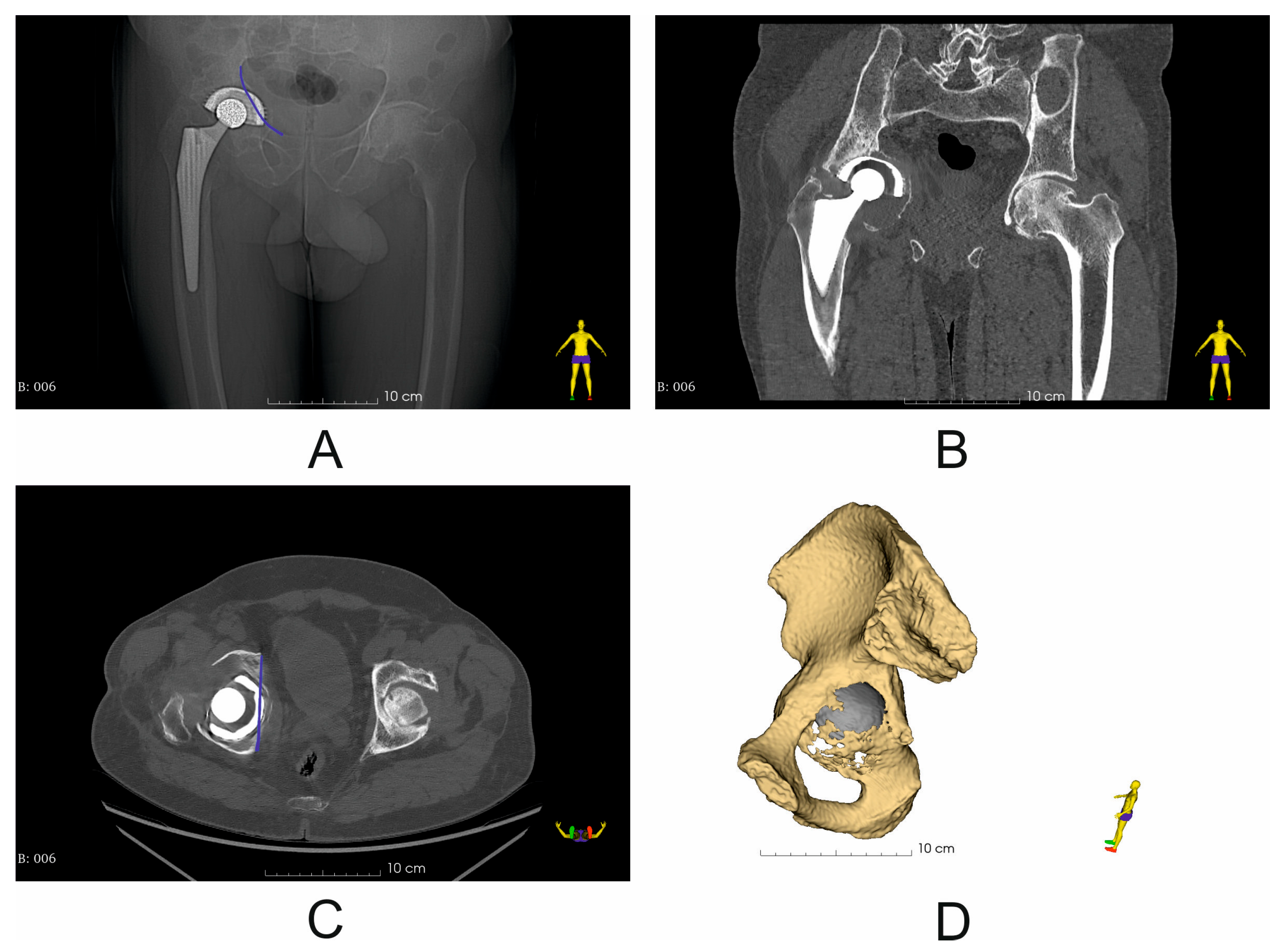 Diagnostics 14 02574 g001