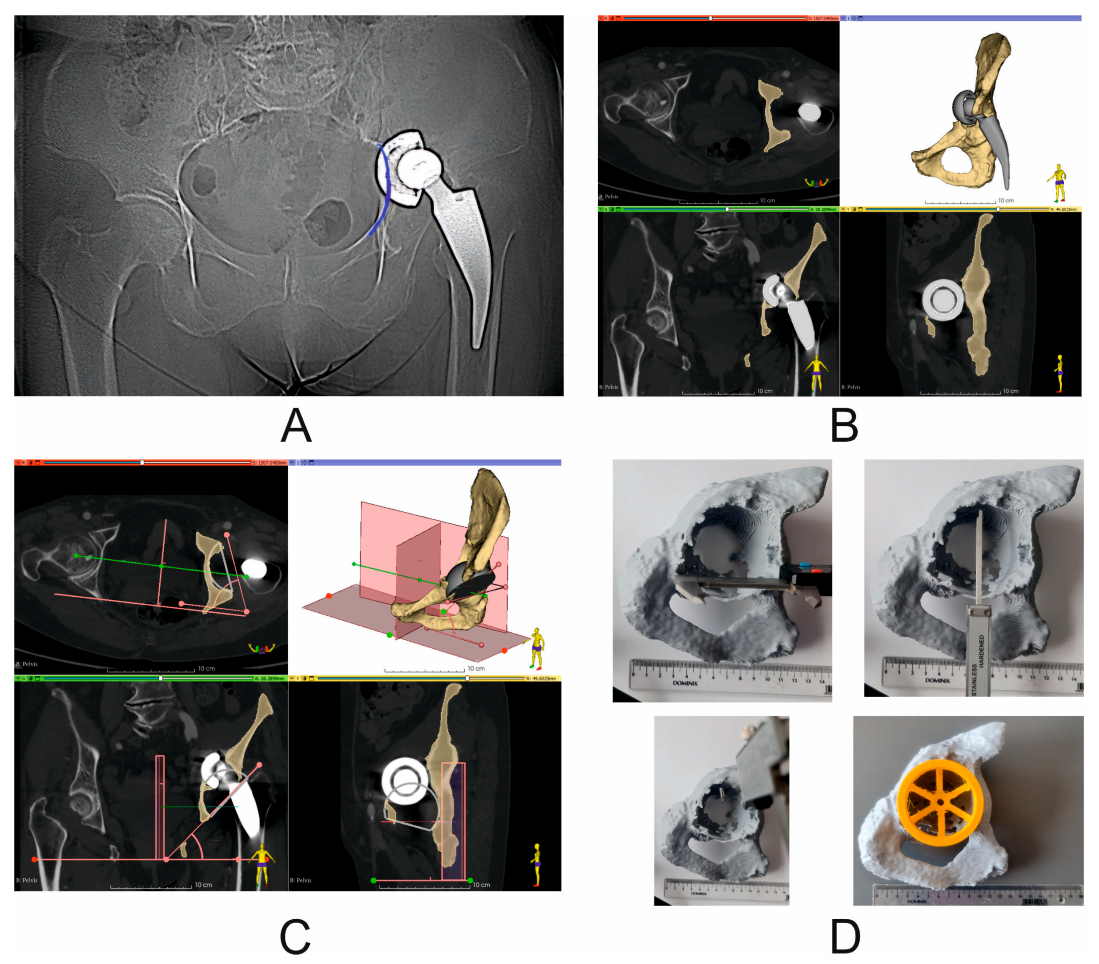 Diagnostics 14 02574 g004