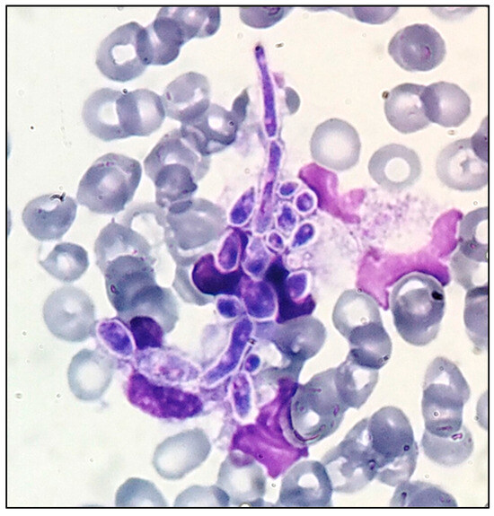 Diagnostics 14 02597 g001