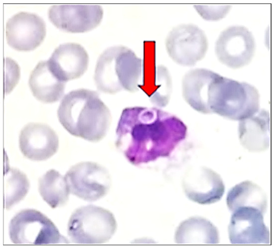 Diagnostics 14 02597 g002