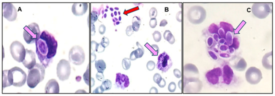 Diagnostics 14 02597 g003