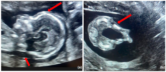 Diagnostics 14 02601 g001