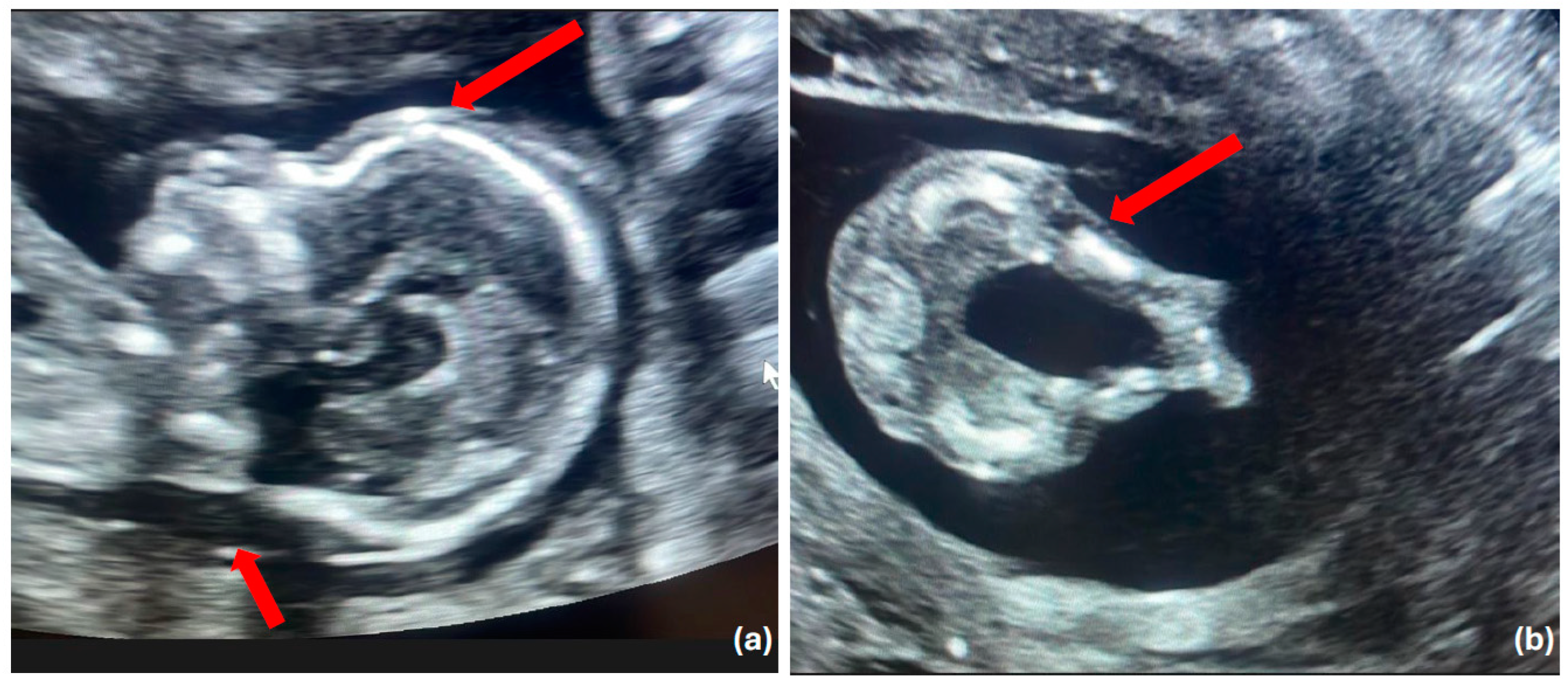 Diagnostics 14 02601 g001