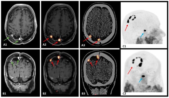 Diagnostics 14 02608 g001