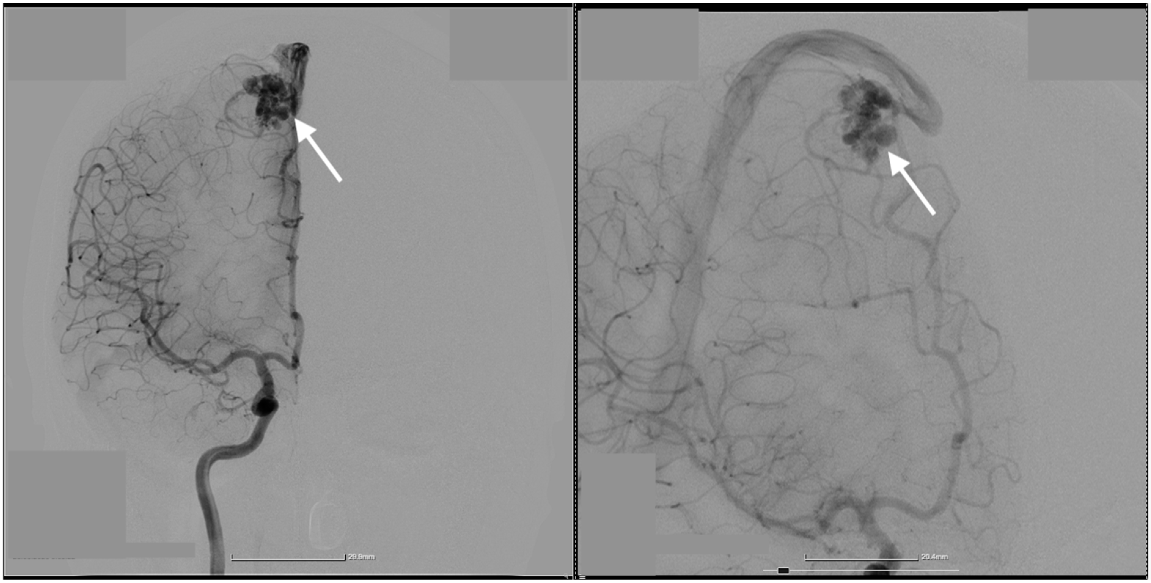 Diagnostics 14 02613 g001
