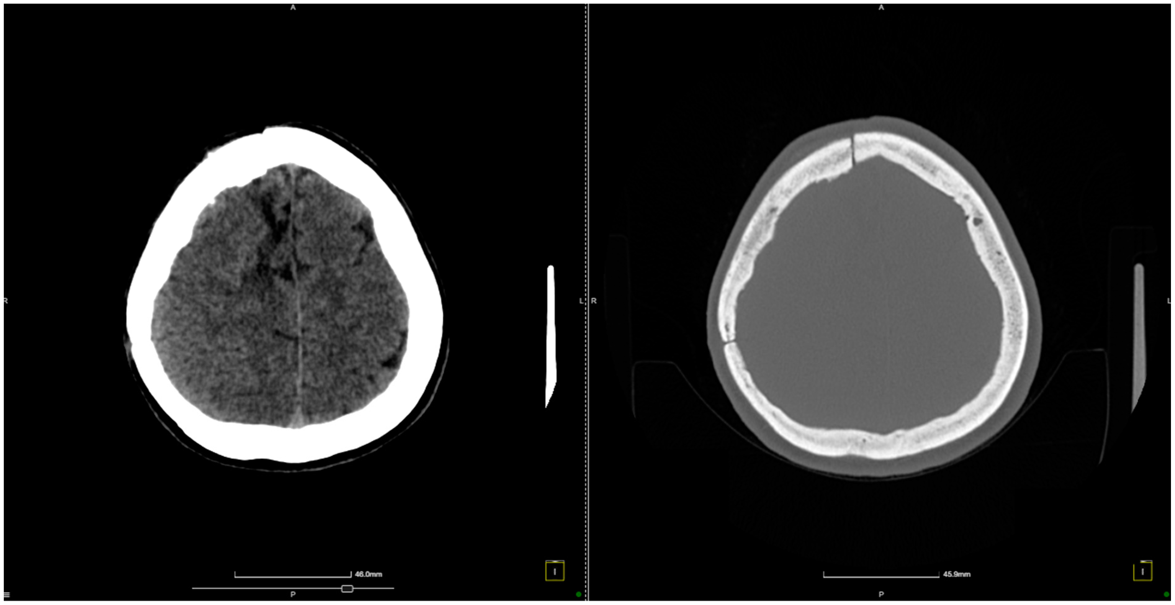 Diagnostics 14 02613 g004