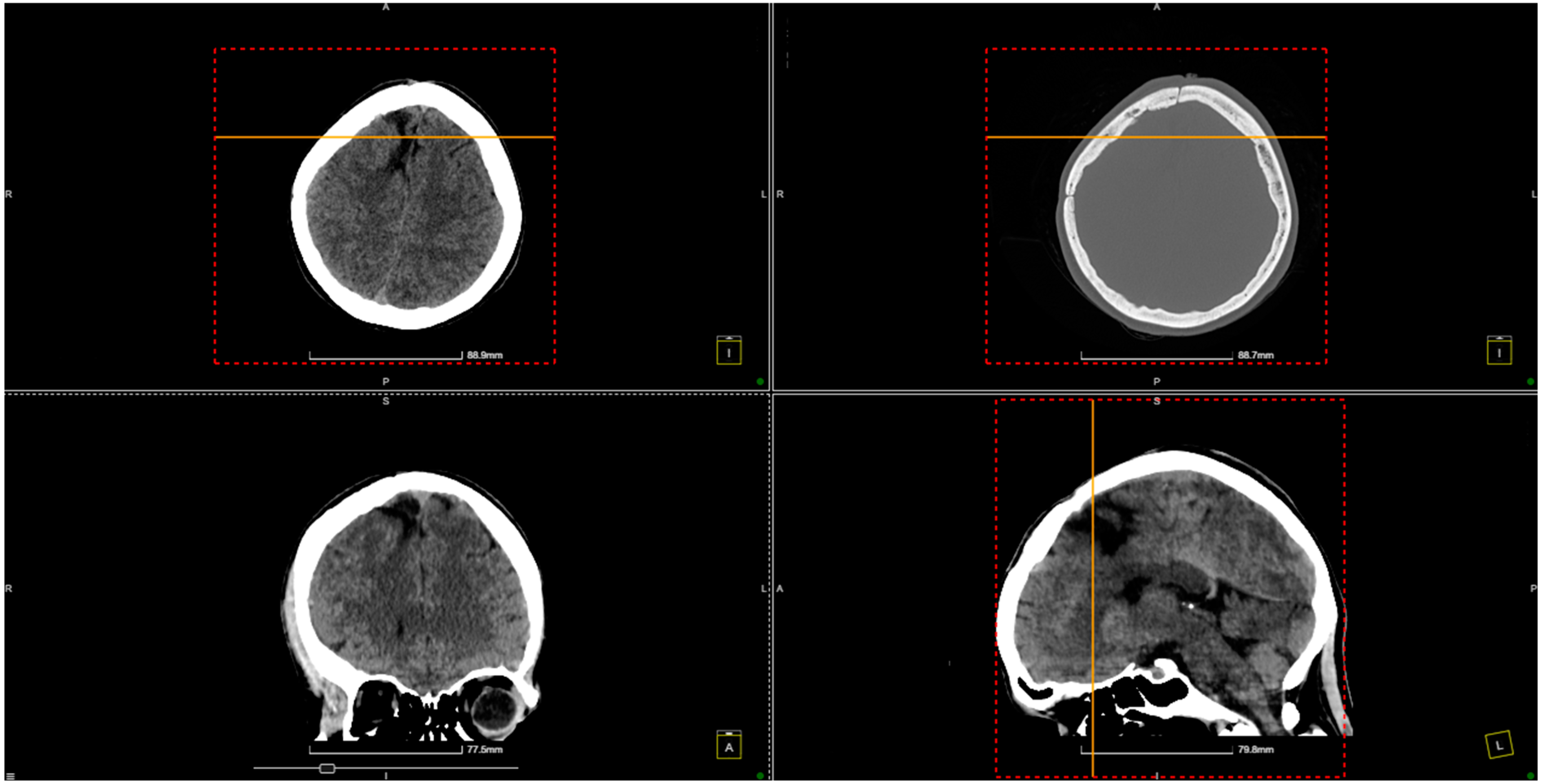Diagnostics 14 02613 g005