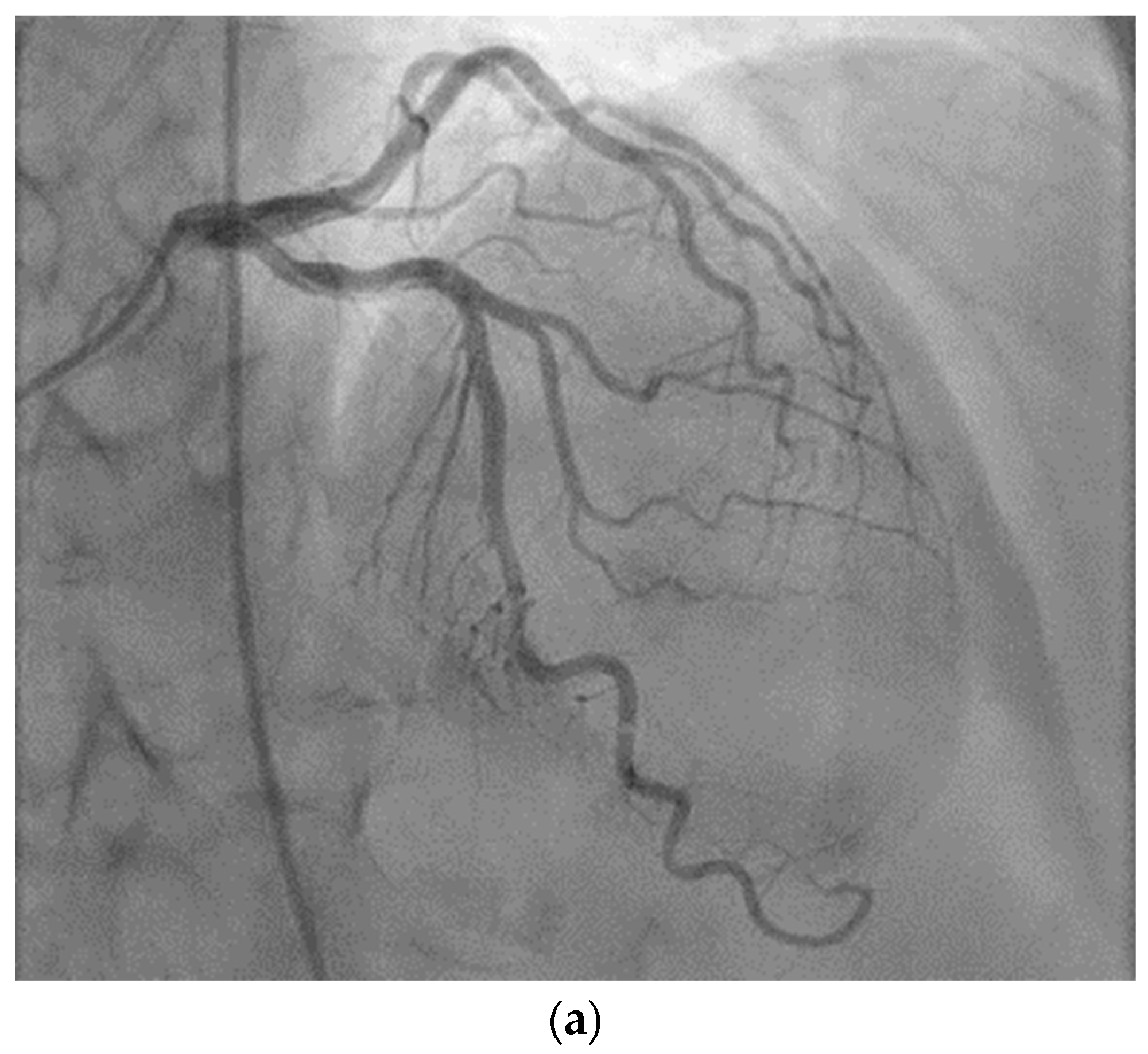Diagnostics 14 02623 g003a