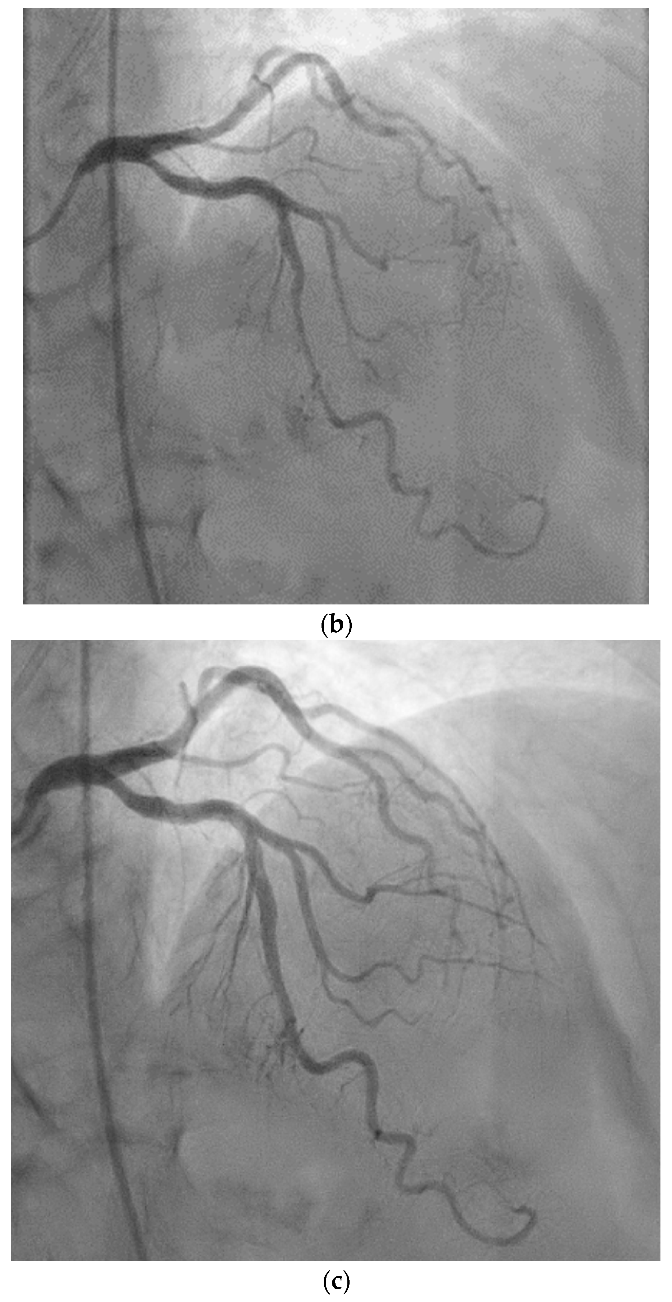 Diagnostics 14 02623 g003b