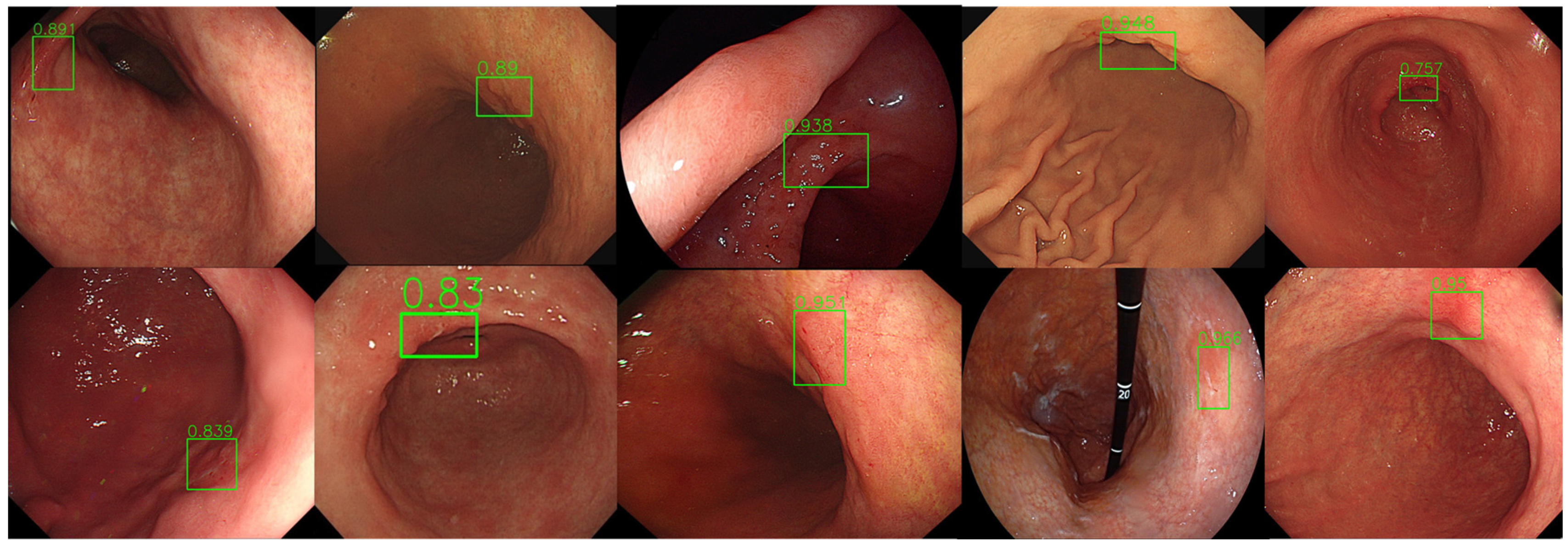 Diagnostics 14 02706 g004 Diagnostics 14 02706 g004