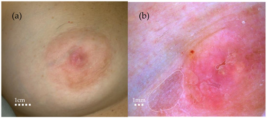 Diagnostics 14 02717 g001