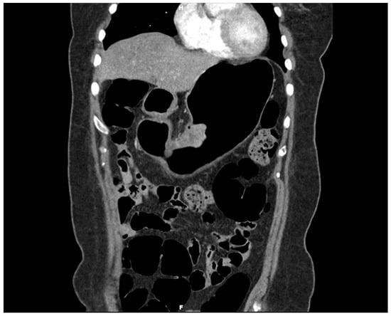 Diagnostics 14 02727 g001