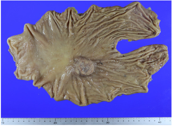 Diagnostics 14 02727 g002