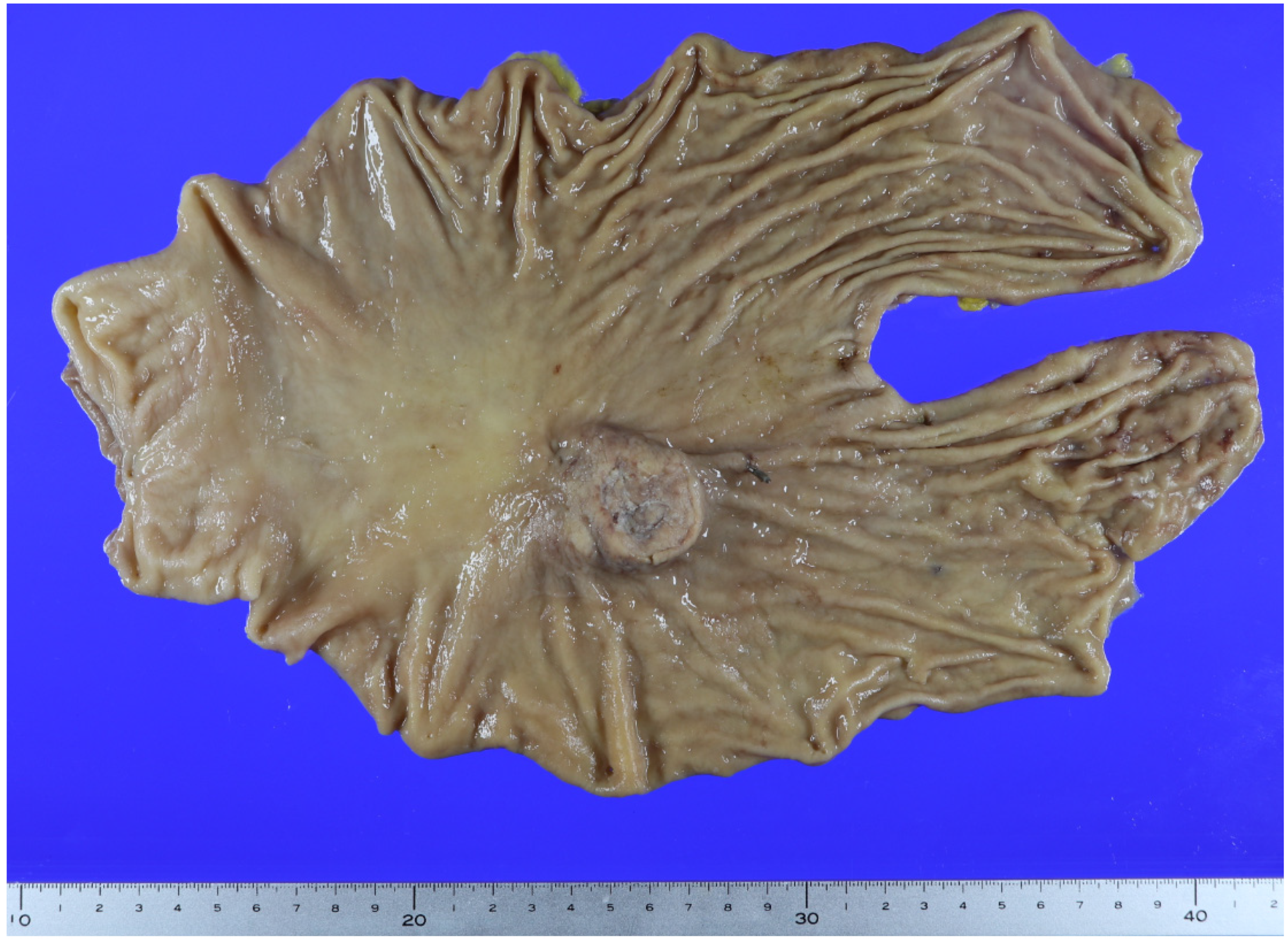 Diagnostics 14 02727 g002