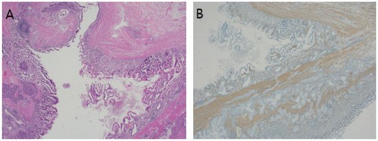 Diagnostics 14 02727 g003