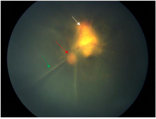 Diagnostics 14 02767 g001