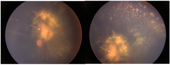 Diagnostics 14 02767 g003