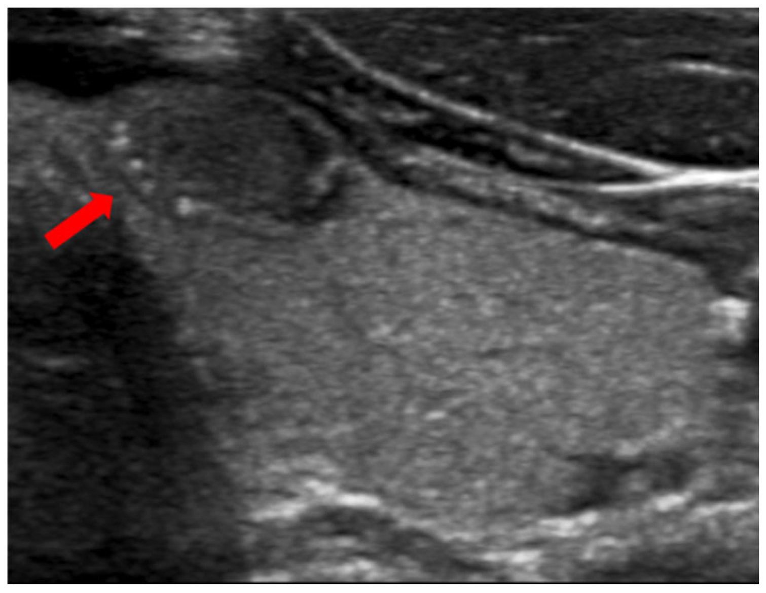 Diagnostics 14 02775 g002