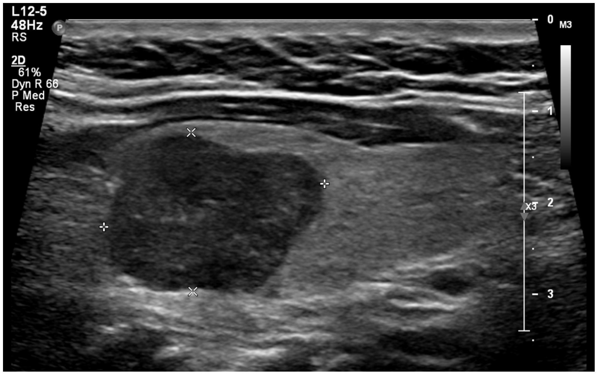 Diagnostics 14 02775 g004