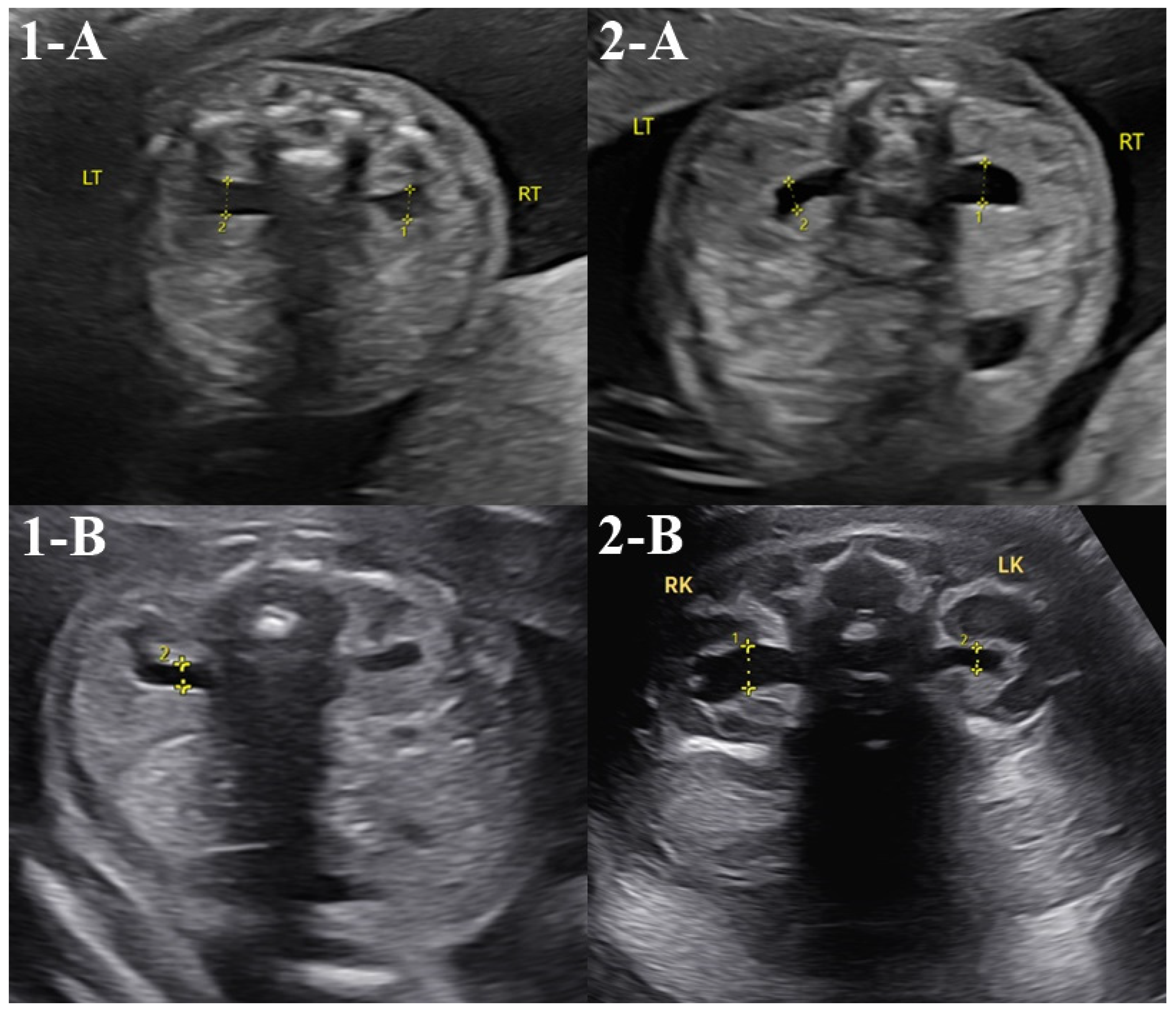 Diagnostics 14 02795 g001