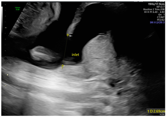 Diagnostics 14 02826 g002