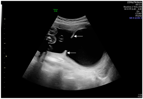 Diagnostics 14 02826 g003