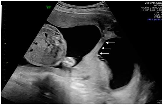 Diagnostics 14 02826 g004