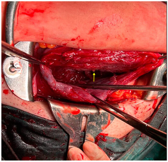 Diagnostics 14 02826 g006