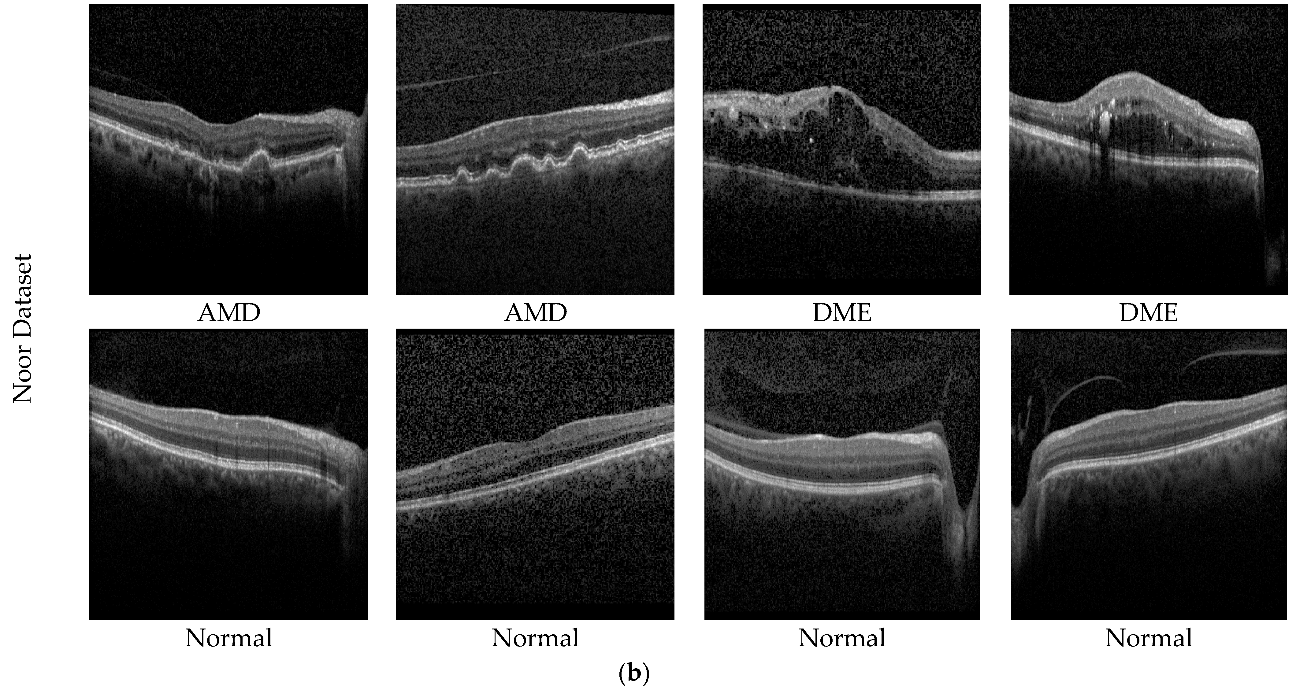 Diagnostics 14 02836 g005b