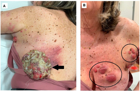 Diagnostics 14 02860 g001