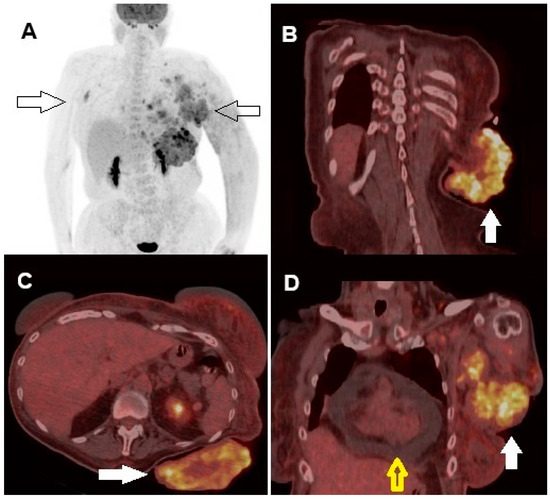 Diagnostics 14 02860 g003