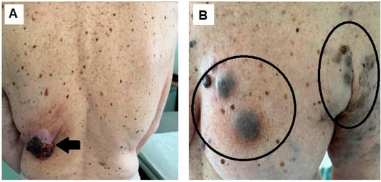 Diagnostics 14 02860 g004