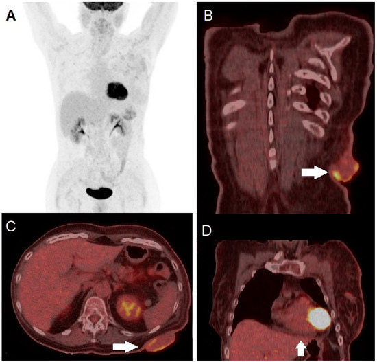 Diagnostics 14 02860 g005