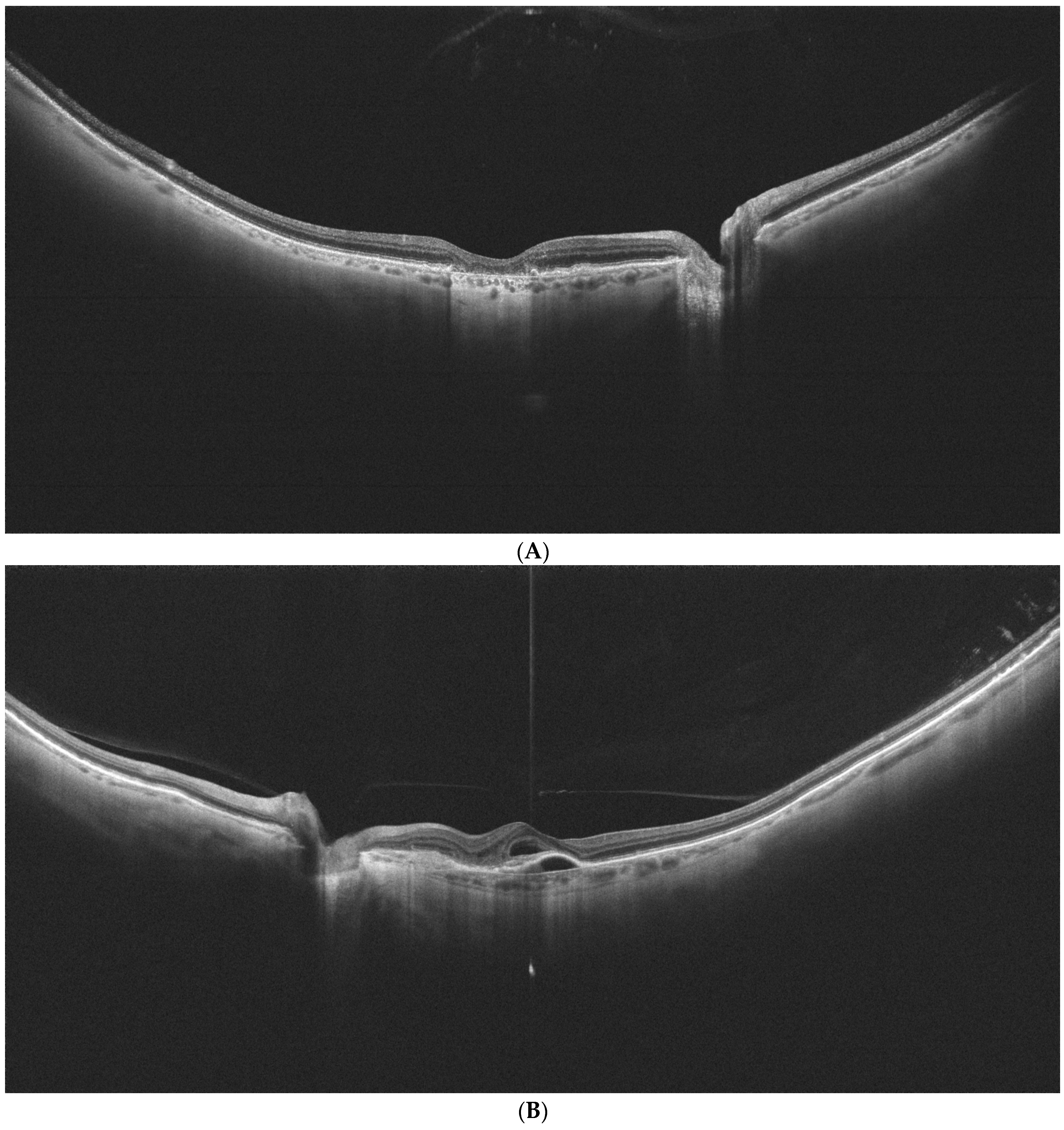Diagnostics 14 02868 g002a Diagnostics 14 02868 g002a