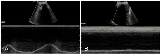 Diagnostics 15 00002 g003