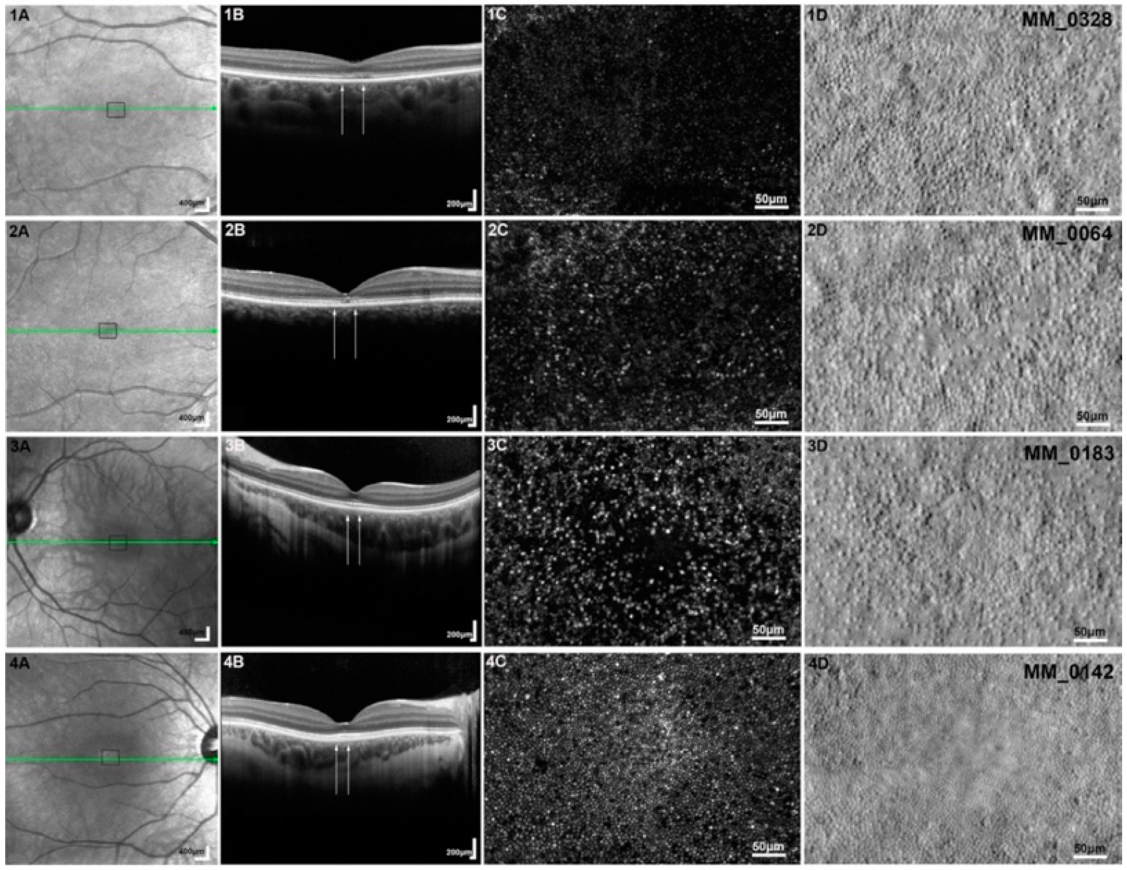 Diagnostics 15 00028 g004