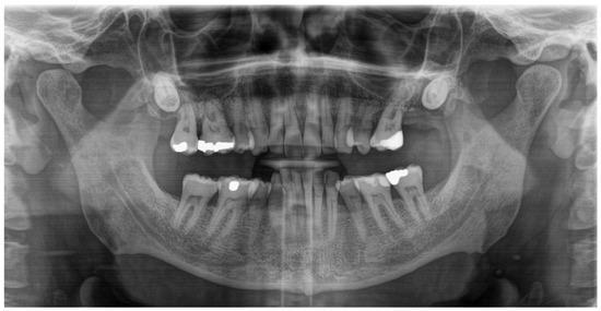 Diagnostics 15 00033 g002
