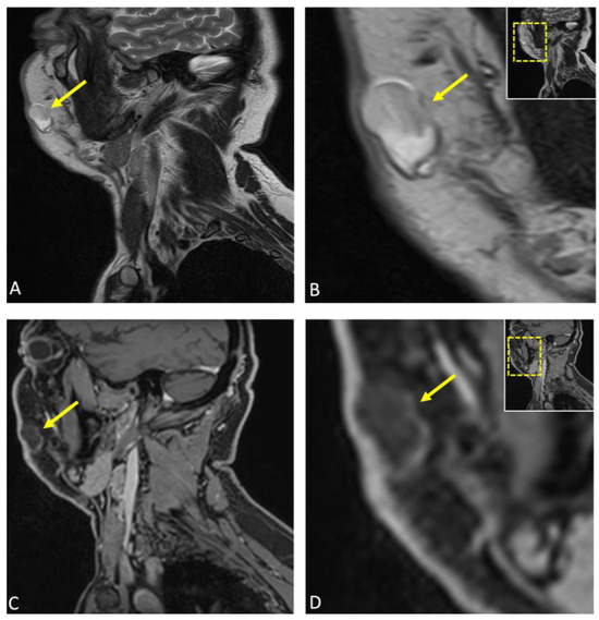 Diagnostics 15 00033 g003