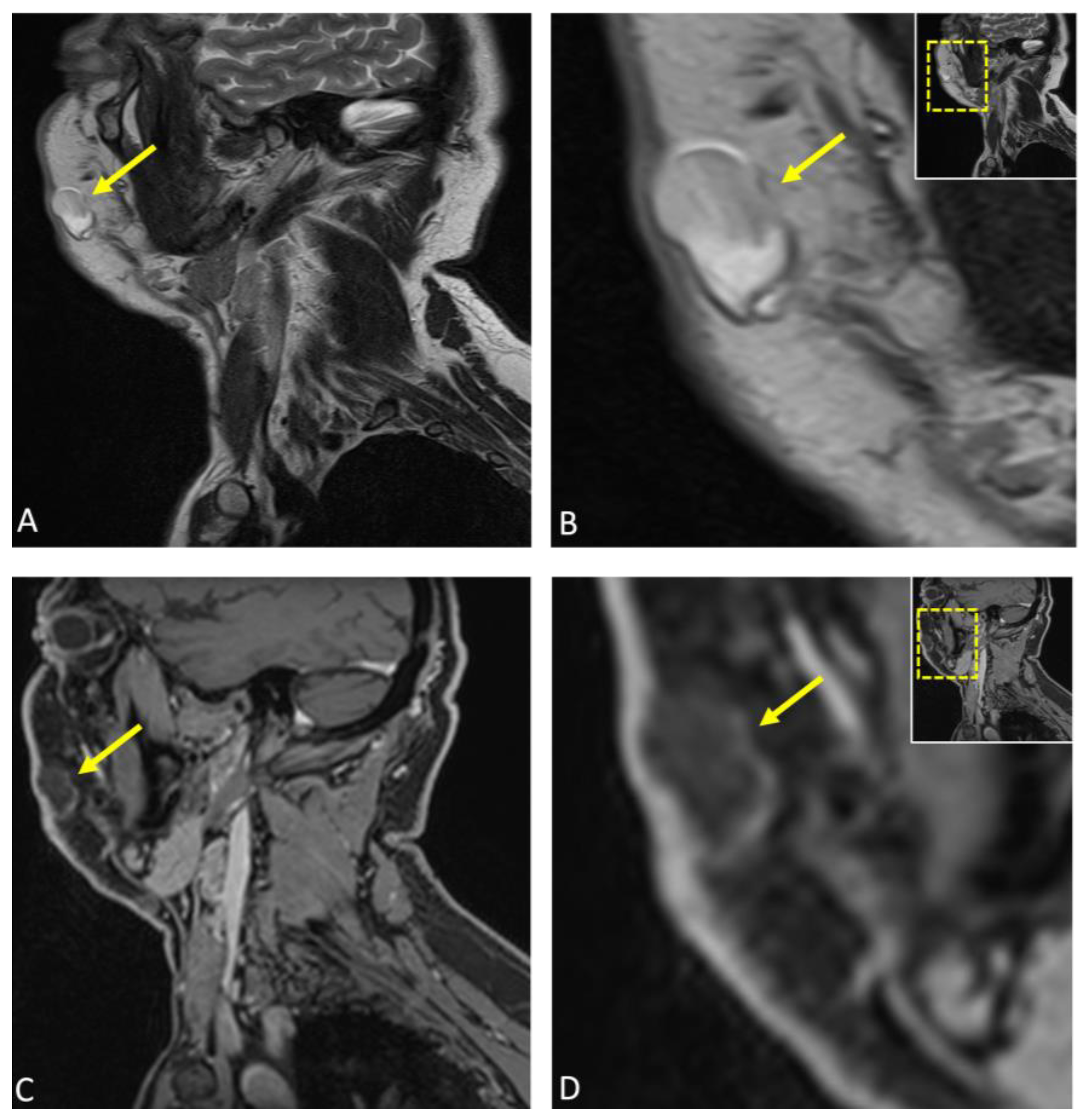 Diagnostics 15 00033 g003