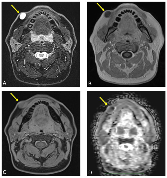 Diagnostics 15 00033 g005