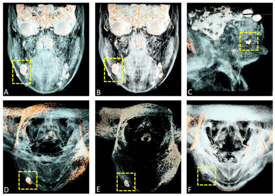 Diagnostics 15 00033 g006