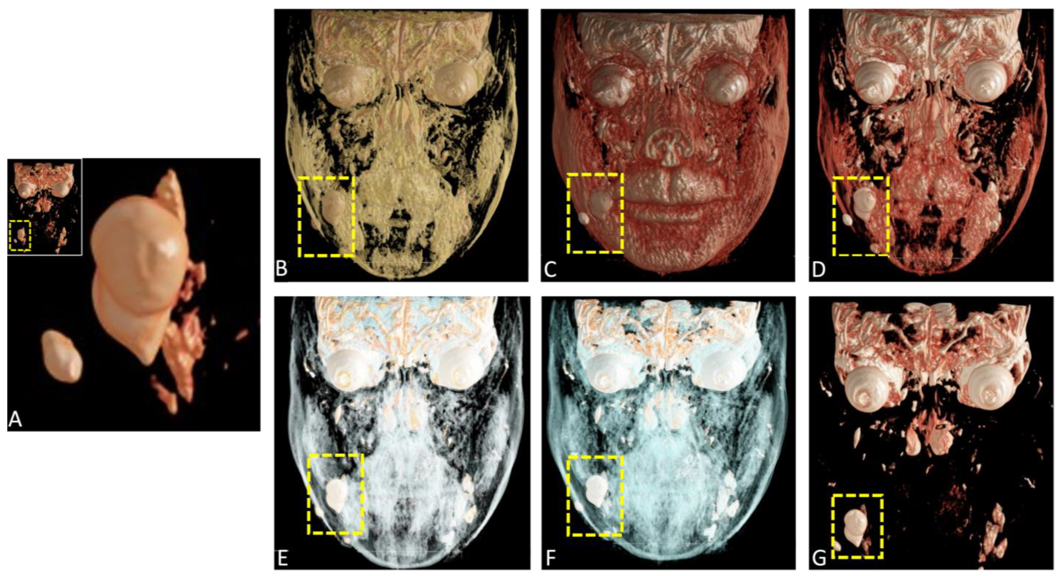 Diagnostics 15 00033 g007